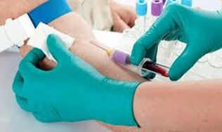 Elbow vein blood fence