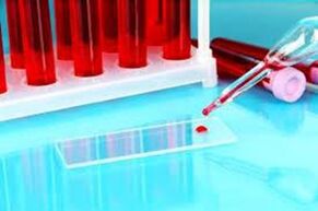 We have timets of blood for parasites