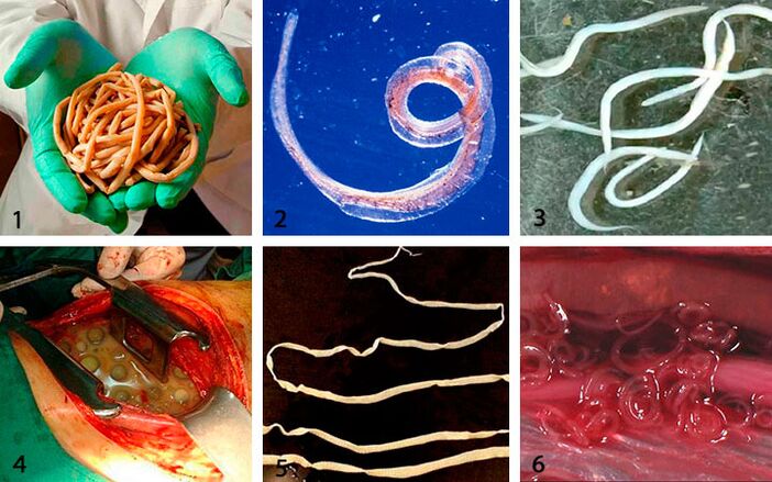 Types of parasites