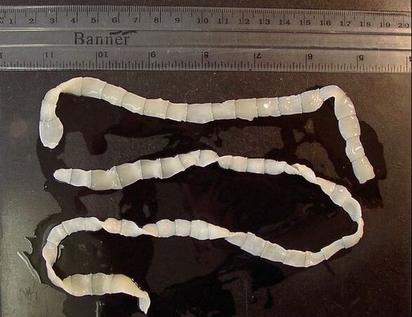 wide tapeworm of the human body