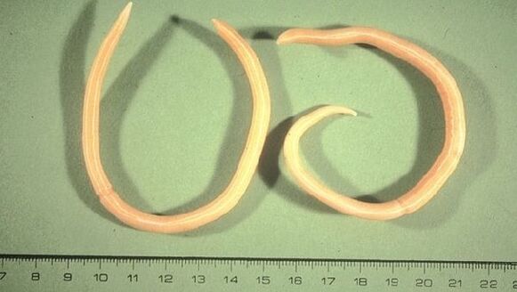 Roundworms are worms that manifest themselves as fatigue and cough.