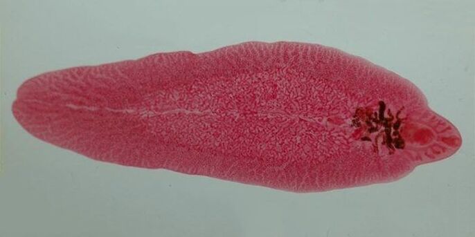 trematode worm in humans