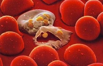 Plasmodium from malaria in the human body. 