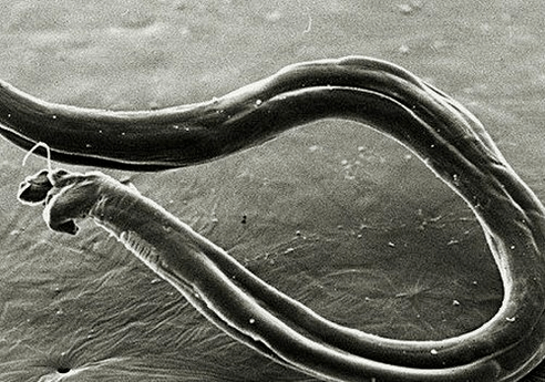 what hookworms look like on the human body