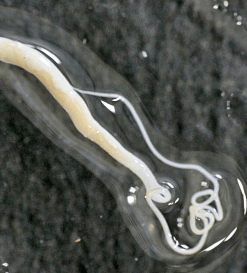 what whipworms look like on the human body