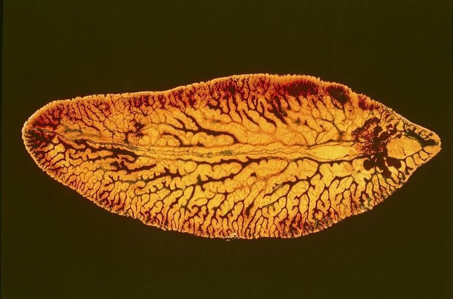 trematode parasite species
